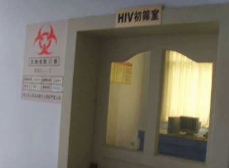 hiv艾滋病实验室